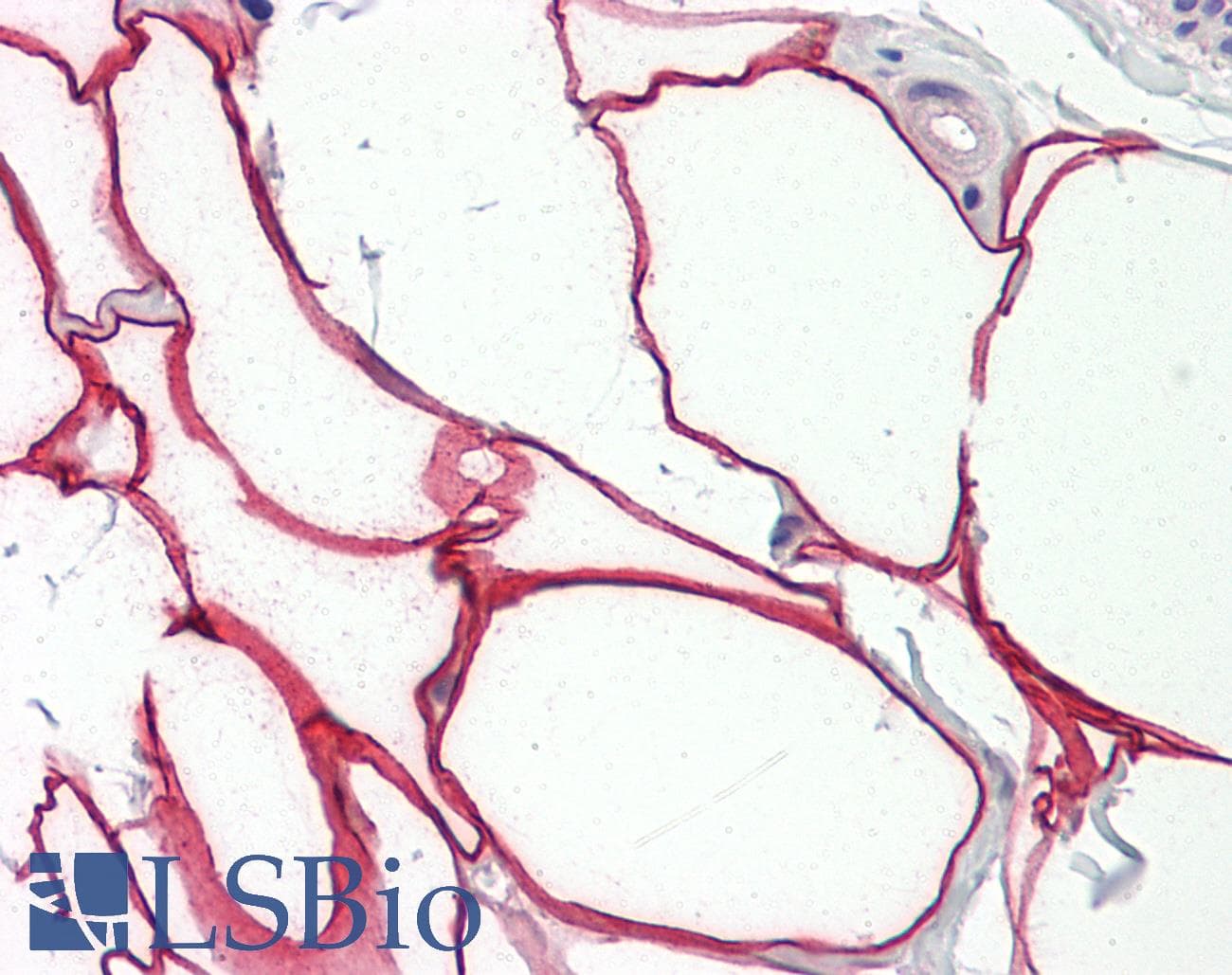 IHC-plus™ ALOX5 / 5-LOX Antibody (aa246-295)