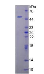 Mouse LL37 / Cathelicidin Protein (Recombinant His-GST, N-terminus)
