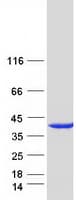 Human UPRT Protein (Recombinant Myc-DDK (Flag))