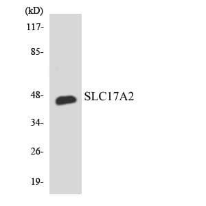 SLC17A2 Antibody (aa201-250)