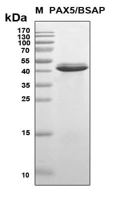 Human PAX5 Protein (Recombinant 6His, N-terminus)