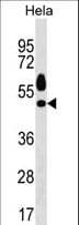 Polyclonal Rabbit anti-Mouse SGK1 / SGK Antibody (aa323-352, WB)