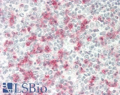 IHC-plus™ PDCD1 / CD279 / PD-1 Antibody (clone 4E5)