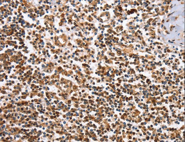 IRAK3 / IRAKM / IRAK-M Antibody