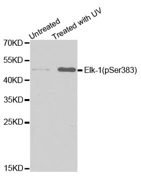 ELK1 Antibody (phospho-Ser383)