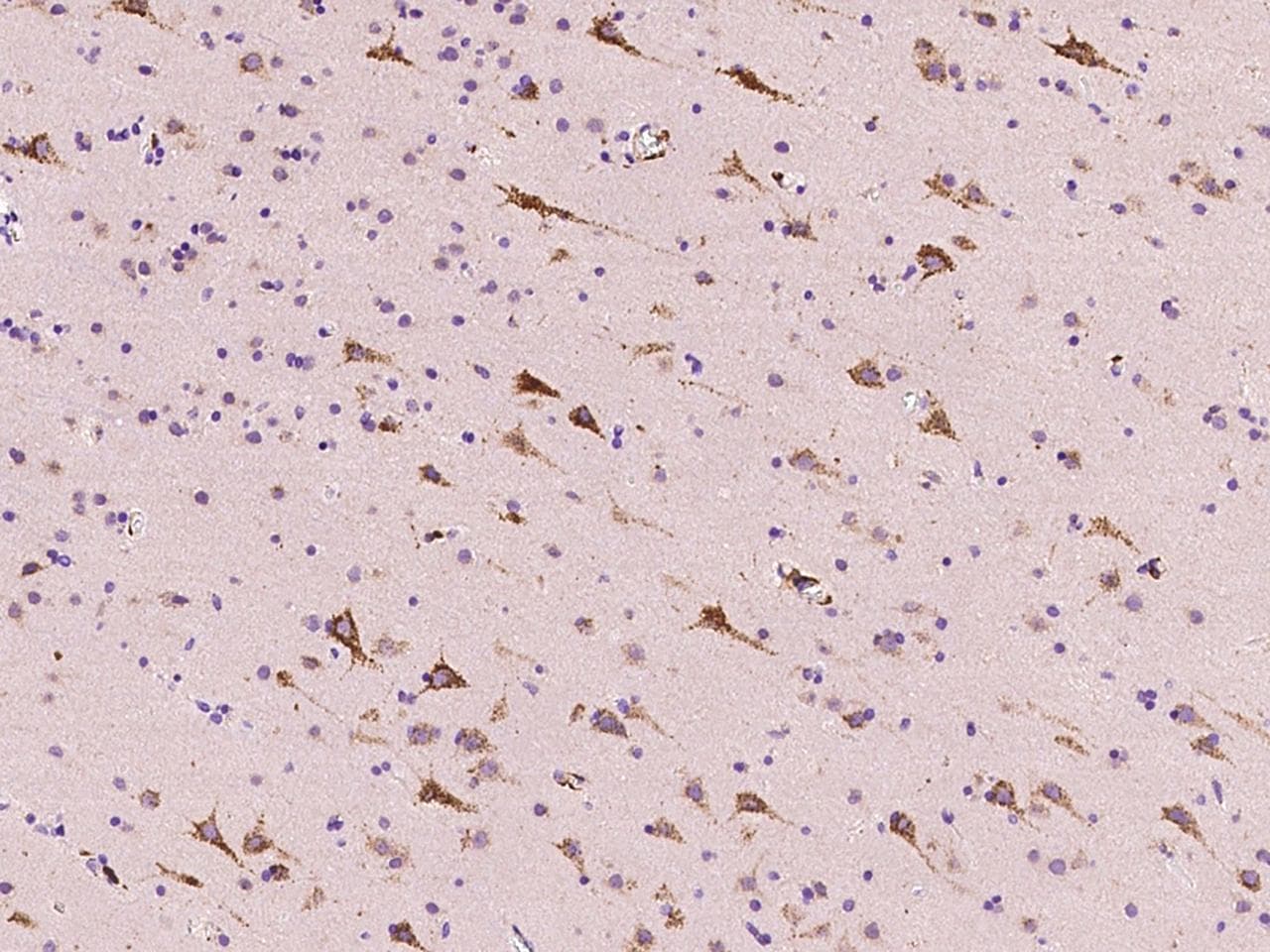 RIPK3 / RIP3 Antibody