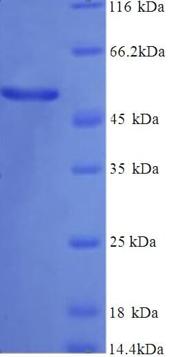 Human GC / Vitamin D-Binding Protein (Recombinant His)