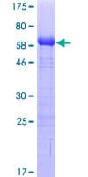 Human TWF1 / PTK9 Protein (Recombinant GST)