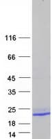 Human TMEM140 Protein (Recombinant Myc-DDK (Flag))