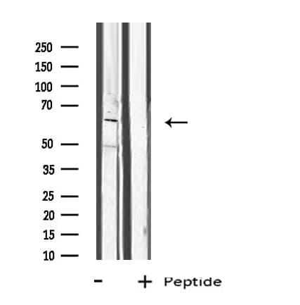 CYP1B1 Antibody