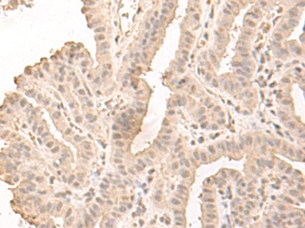 SAP130 Antibody