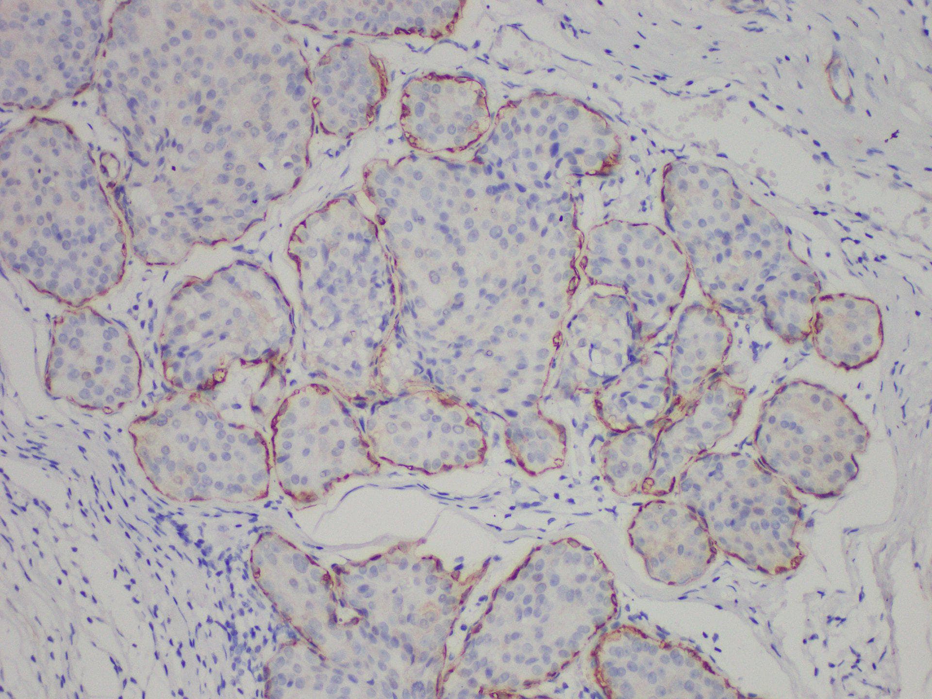 Monoclonal Mouse CNN1 / Calponin Antibody (IHC)