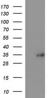 TXNDC1 / TMX1 Antibody (clone OTI1G1)