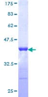 Human TRIM21 / RO52 Protein (Recombinant GST, N-terminus)