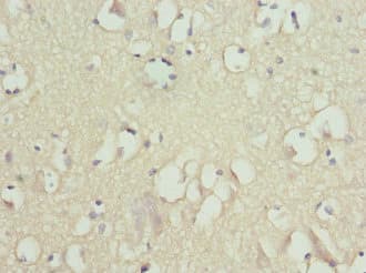 FXYD2 Antibody