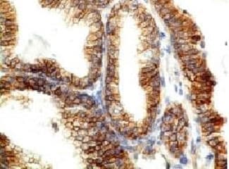 CDH1 / E Cadherin Antibody (clone CDH1/1525, Azide-free, BSA-free)