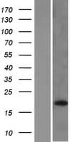 DUSP28 Protein (Over-Expression Lysate Myc-DDK (Flag))