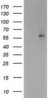 PPARA / PPAR Alpha Antibody (aa145-420, clone OTI1E8, Carrier-free)