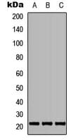 Polyclonal Rabbit anti-Human TGIF2LY Antibody (Internal, WB)