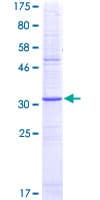 Human TACR1 / NK1R Protein (Recombinant GST, N-terminus)