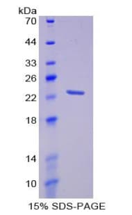Human PALS2 / MPP6 Protein (Recombinant His-T7)