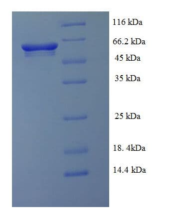 Clostridium difficile gluD Protein (Recombinant His-SUMO)