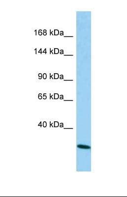 C1QDC1 / Caprin-2 Antibody (aa65-114)