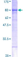 Human Carboxylesterase 1 / CES1 Protein (Recombinant GST)