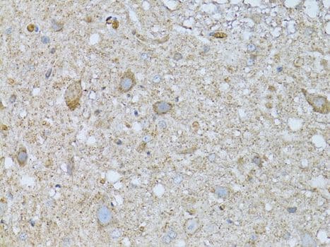 Polyclonal Rabbit anti-Human PHLDA2 / TSSC3 Antibody (IHC, WB)