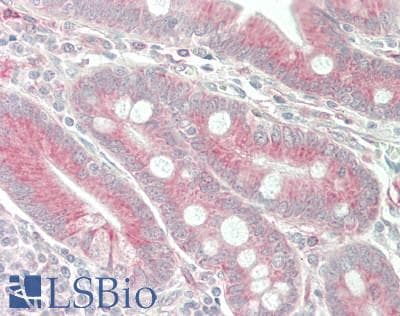 Polyclonal Rabbit anti-Human CCL25 / TECK Antibody (aa24-150, IHC, WB)