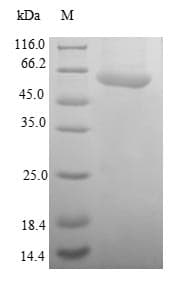 Human SAE1 Protein (Recombinant GST, N-terminus)