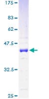Human HMGN1 / HMG14 Protein (Recombinant GST)