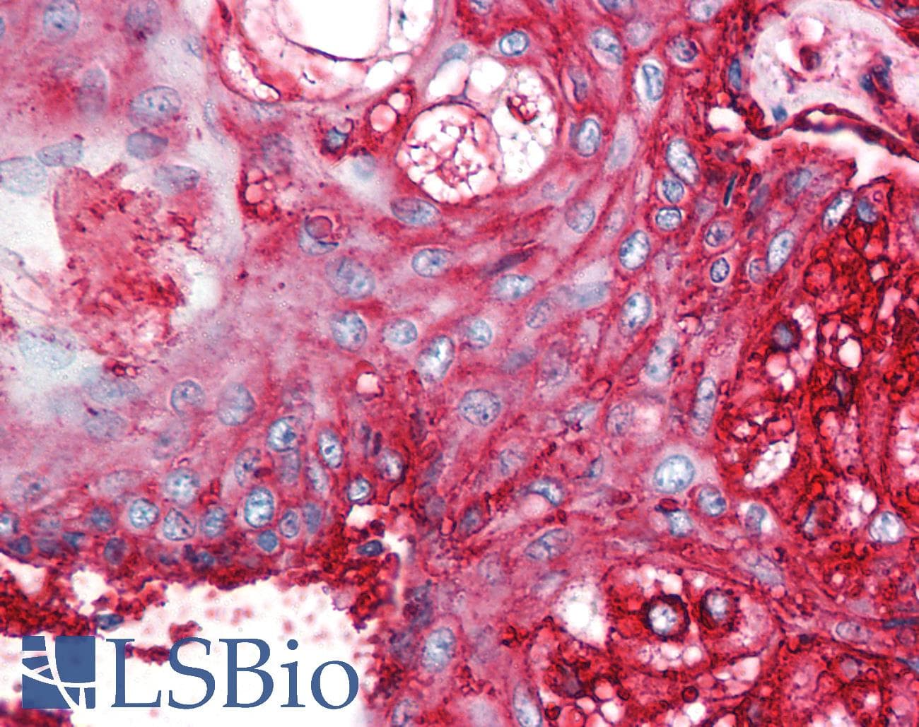 PathPlus™ CD59 Antibody (clone MEM-43/5)