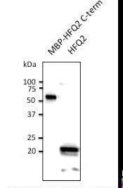 Polyclonal Goat anti-Burkholderia Burkholderia cenocepacia Hfq2 Antibody (C-Terminus, WB)