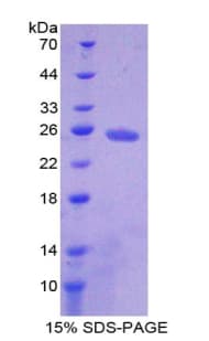 Mouse ADCY4 / Adenylate Cyclase 4 Protein (Recombinant His-T7)
