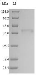 Human COLEC11 Protein (Recombinant 10His, N-terminus + Myc, C-terminus)
