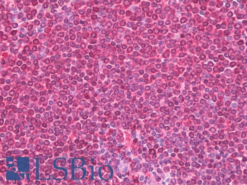 IHC-plus™ Polyclonal Rabbit anti-Human PLCG1 Antibody (aa751-800, IHC, WB)