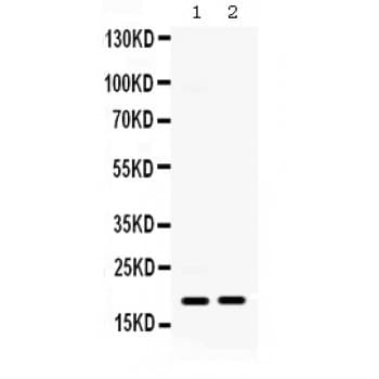 CXCL10 / IP-10 Antibody (aa22-98)