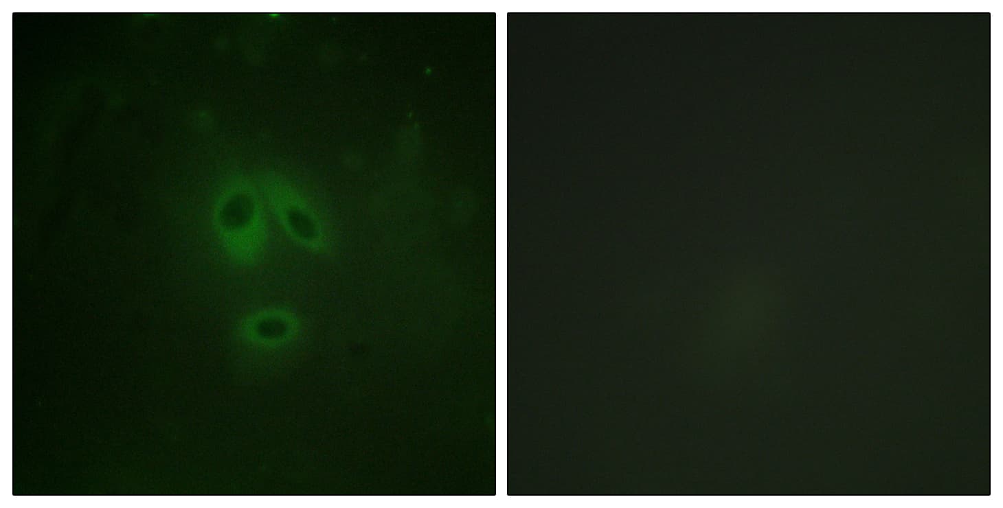 NOS1 / nNOS Antibody (phospho-Ser852)