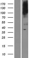 SLC39A8 / ZIP8 Protein (Over-Expression Lysate Myc-DDK (Flag))