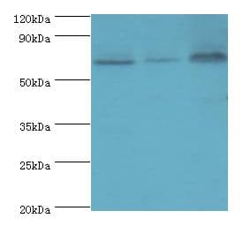 PIAS2 / PIASX Antibody (aa532-621)