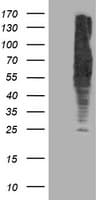 DLD / Diaphorase / E3 Antibody (clone OTI4D5)