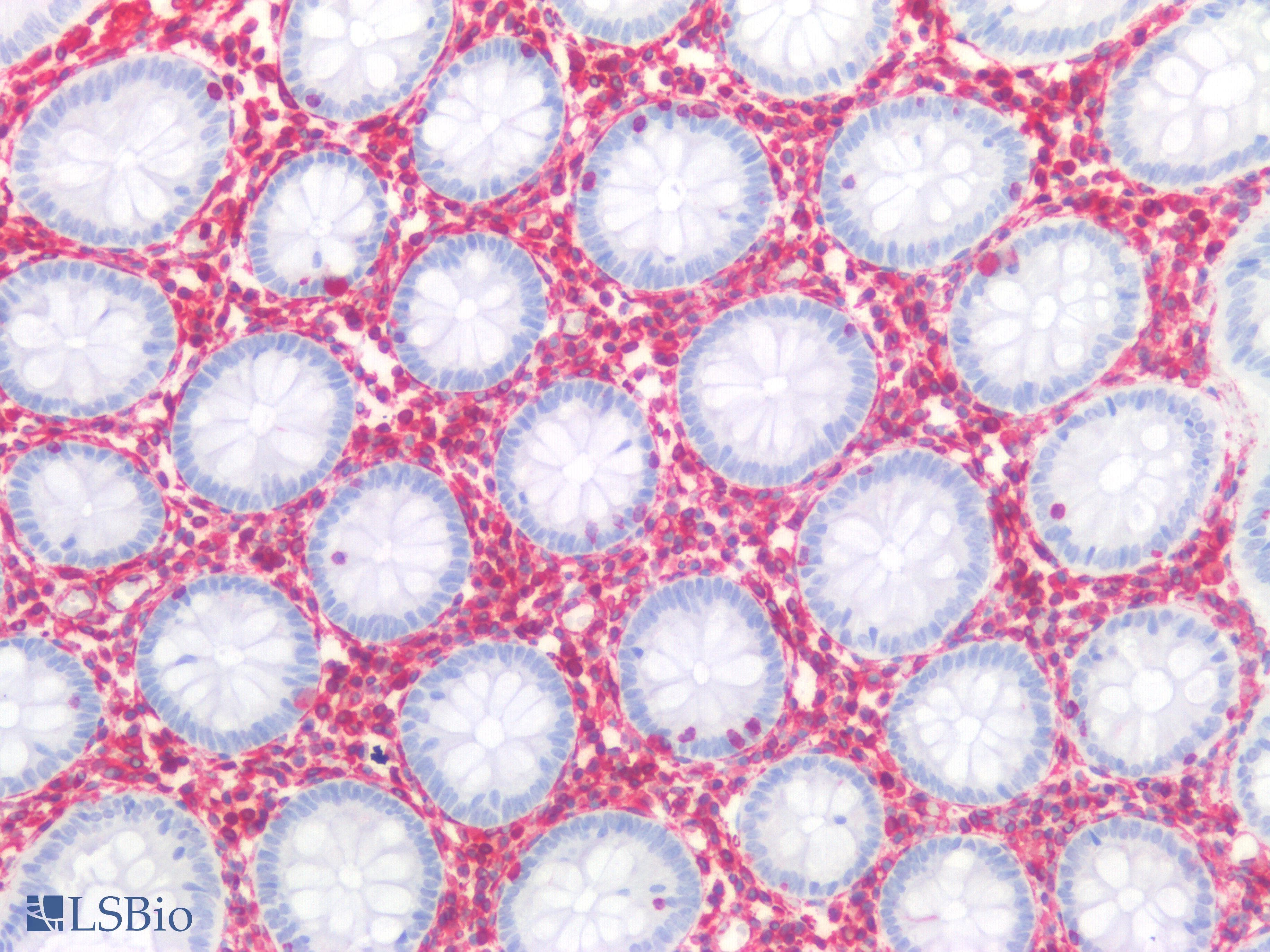 PathPlus™ Polyclonal Rabbit anti-Human Vimentin Antibody (IHC)