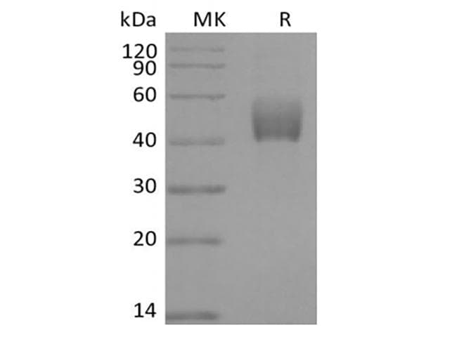 Mouse TGFBR1 / ALK5 Protein (Recombinant Fc, C-terminus)