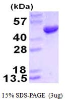 Human HMBS / PBGD Protein (Recombinant His)