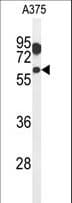 ZACN Antibody (aa331-360)
