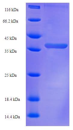 Aeromonas hydrophila fkpA Protein (Recombinant His-SUMO)