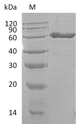 Mouse NT5E / eNT / CD73 Protein (Recombinant 6His, C-terminus)