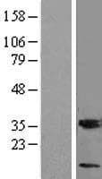 MGST3 Protein (Over-Expression Lysate Myc-DDK (Flag))
