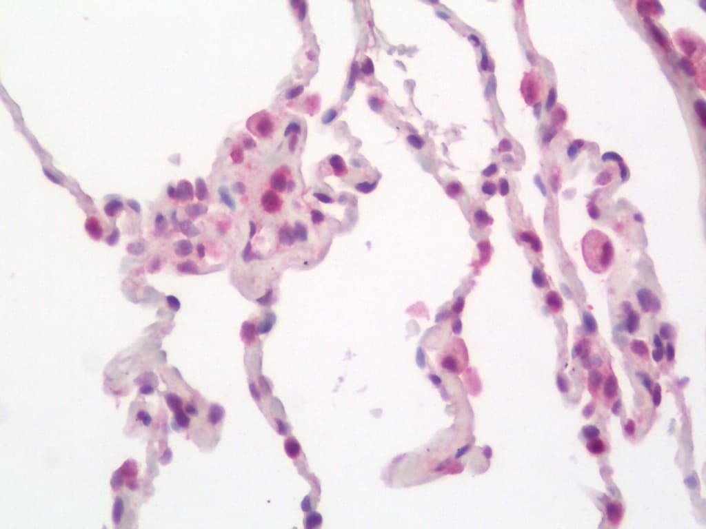 IHC-plus™ UVRAG Antibody